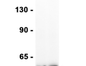 PDI Recombinant antibody