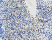 S100A10 Recombinant antibody