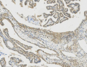 STAT6 Recombinant antibody