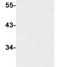 STAT6 Recombinant antibody