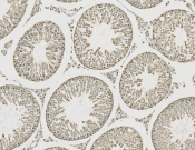 VCP Recombinant antibody