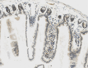 Apoe Recombinant antibody