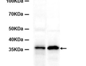 Apoe Recombinant antibody