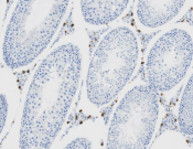 ATM Recombinant antibody