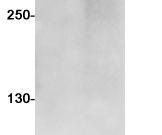 ATM Recombinant antibody
