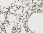 ATP6V1B1 Recombinant antibody