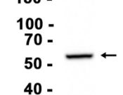 ATP6V1B1 Recombinant antibody