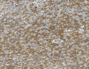 B7-H4 Recombinant antibody