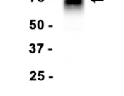 B7-H4 Recombinant antibody