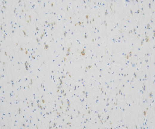 CCL20?Recombinant antibody