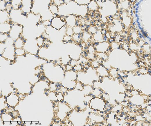 CD200?Recombinant antibody