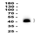 CD200?Recombinant antibody
