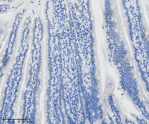 CD68?Recombinant antibody
