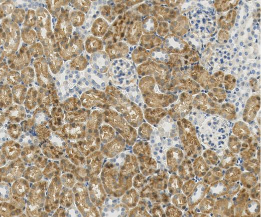 CEBPB?Recombinant antibody