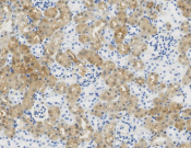 CPS1?Recombinant antibody