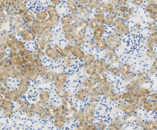 CPS1?Recombinant antibody