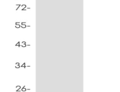 CPS1?Recombinant antibody