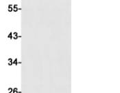 Cystatin C?Recombinant antibody