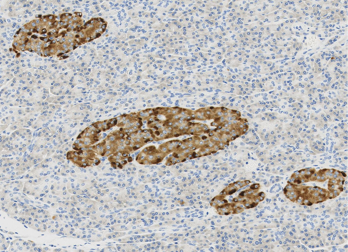 Cystatin C?Recombinant antibody