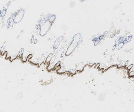 CytokeRin 18?Recombinant antibody
