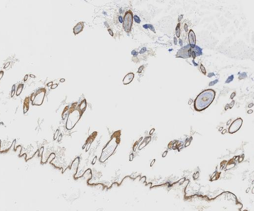 CytokeRin 39?Recombinant antibody