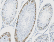 DAZL?Recombinant antibody