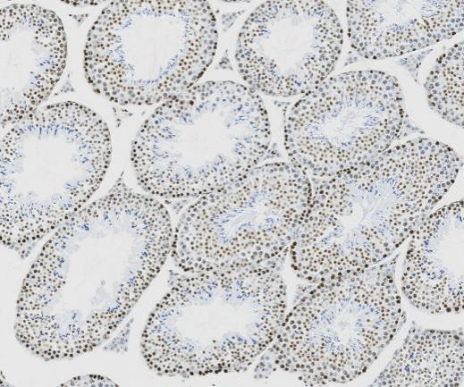 Di/Tri-Methyl-Histone H3 (Lys36)?Recombinant antibody