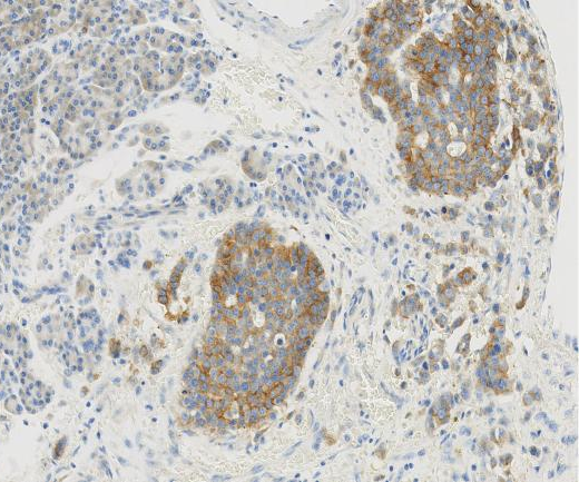 DLX6?Recombinant antibody