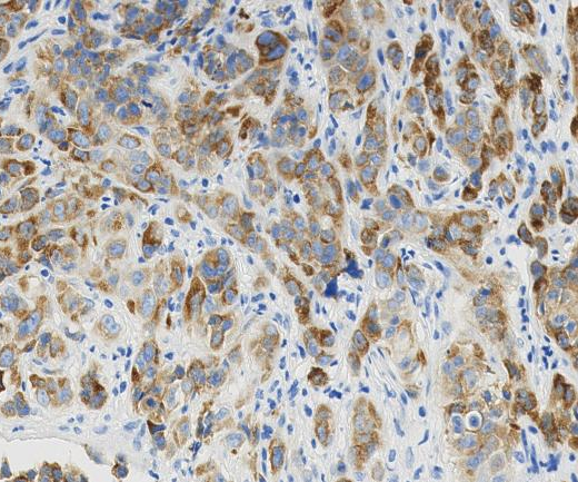 Drebrin?Recombinant antibody