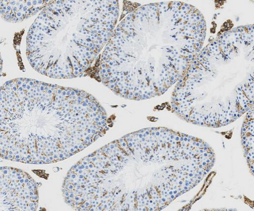 ECHS1?Recombinant antibody