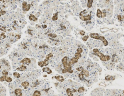 ENO1?Recombinant antibody