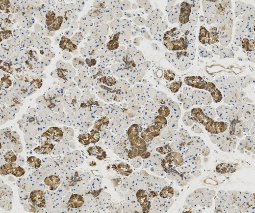 ENO1?Recombinant antibody