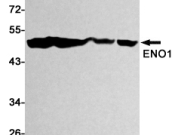 ENO1?Recombinant antibody