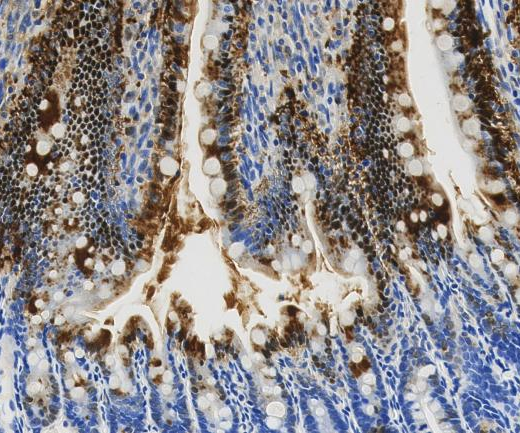 FBP2?Recombinant antibody