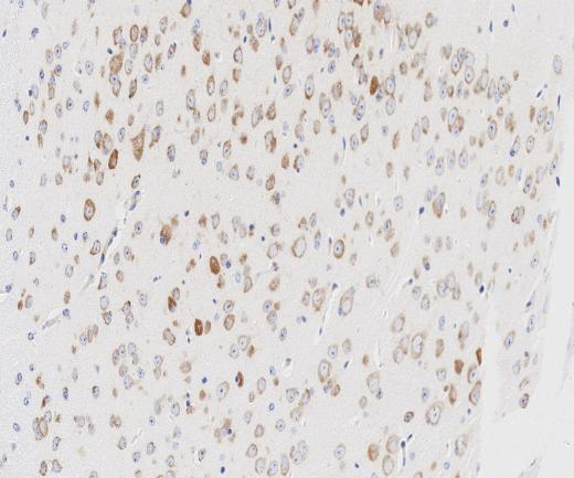 TP63?Recombinant antibody