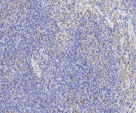 TPRG1L?Recombinant antibody