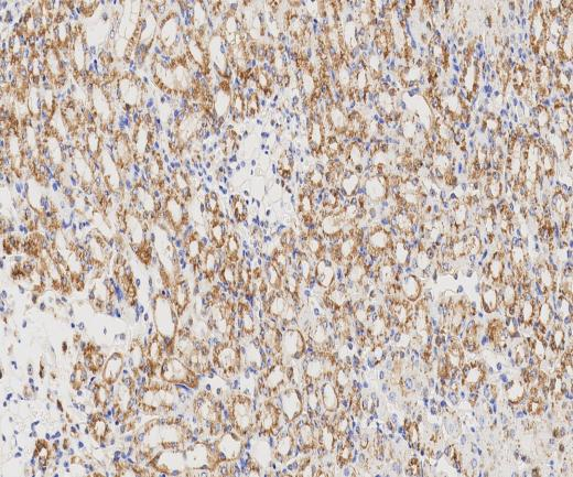 TPRG1L?Recombinant antibody