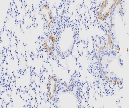 transgelin?Recombinant antibody