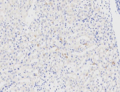 TYRO3?Recombinant antibody