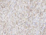 UCH-L1?Recombinant antibody