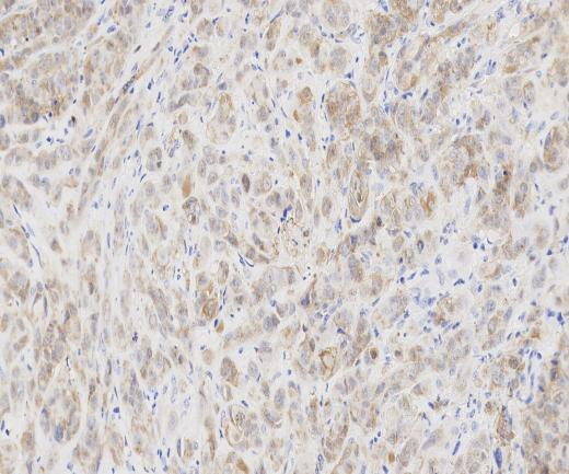 UCH-L1?Recombinant antibody