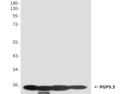 UCH-L1?Recombinant antibody
