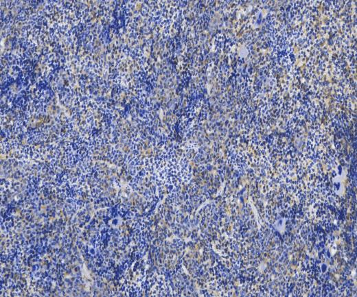 uPAR?Recombinant antibody