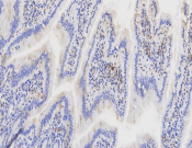 AP2S1 Recombinant antibody