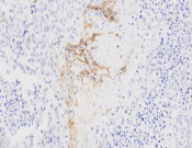 CD155 Recombinant antibody