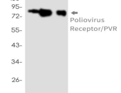 CD155 Recombinant antibody