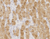 CD23 Recombinant antibody
