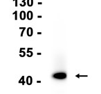 CD23 Recombinant antibody