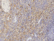 CD31 Recombinant antibody