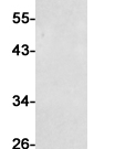 CD31 Recombinant antibody